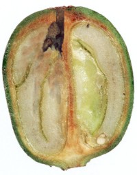 <p>Broca</p> <p>Broca</p>