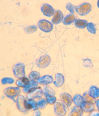<p>Proliferación microscópica del hongo Lecanicillium lecanii (óvalos y tubos pequeños) sobre las uredosporas de Hemileia vastatrix</p>