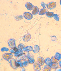<p>Proliferación microscópica del hongo Lecanicillium lecanii (óvalos y tubos pequeños) sobre las uredosporas de Hemileia vastatrix</p> <p>Proliferación microscópica del hongo Lecanicillium lecanii (óvalos y tubos pequeños) sobre las uredosporas de Hemileia vastatrix</p>